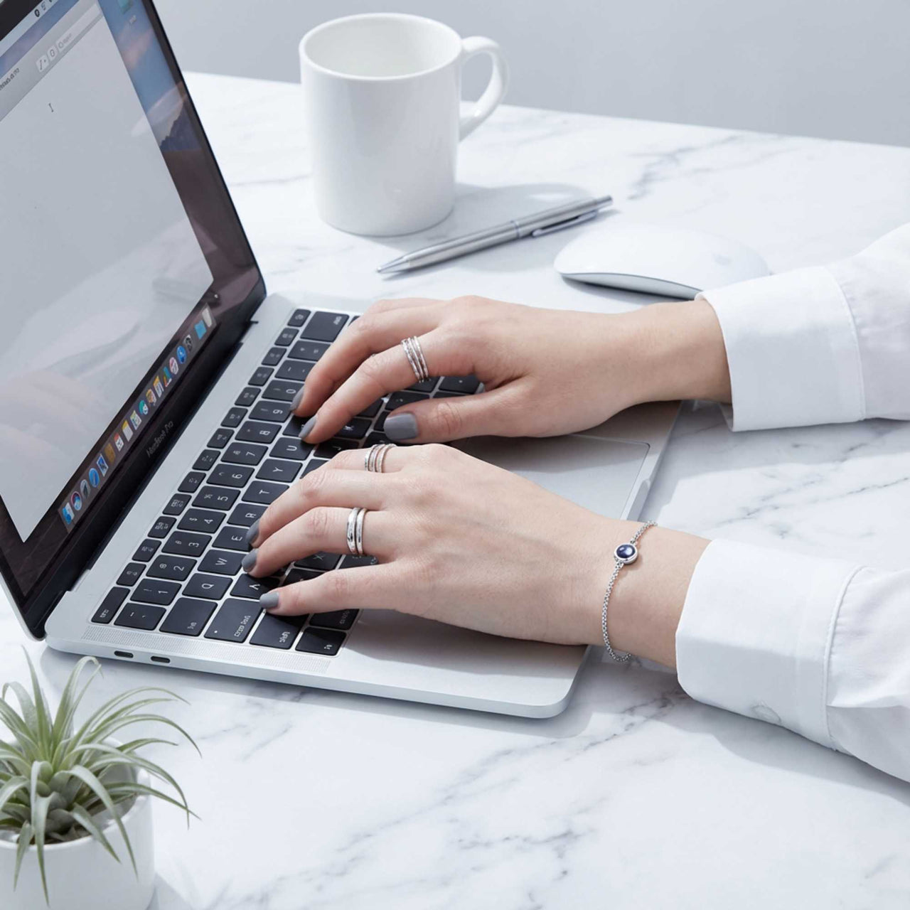 Photo Projection Bracelet - From Ultrasound to Forever